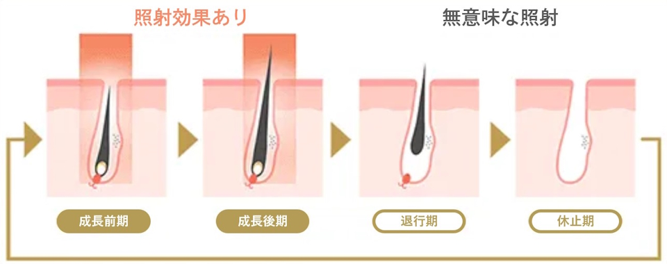 毛周期に合わせた最適なタイミングでの治療が可能！